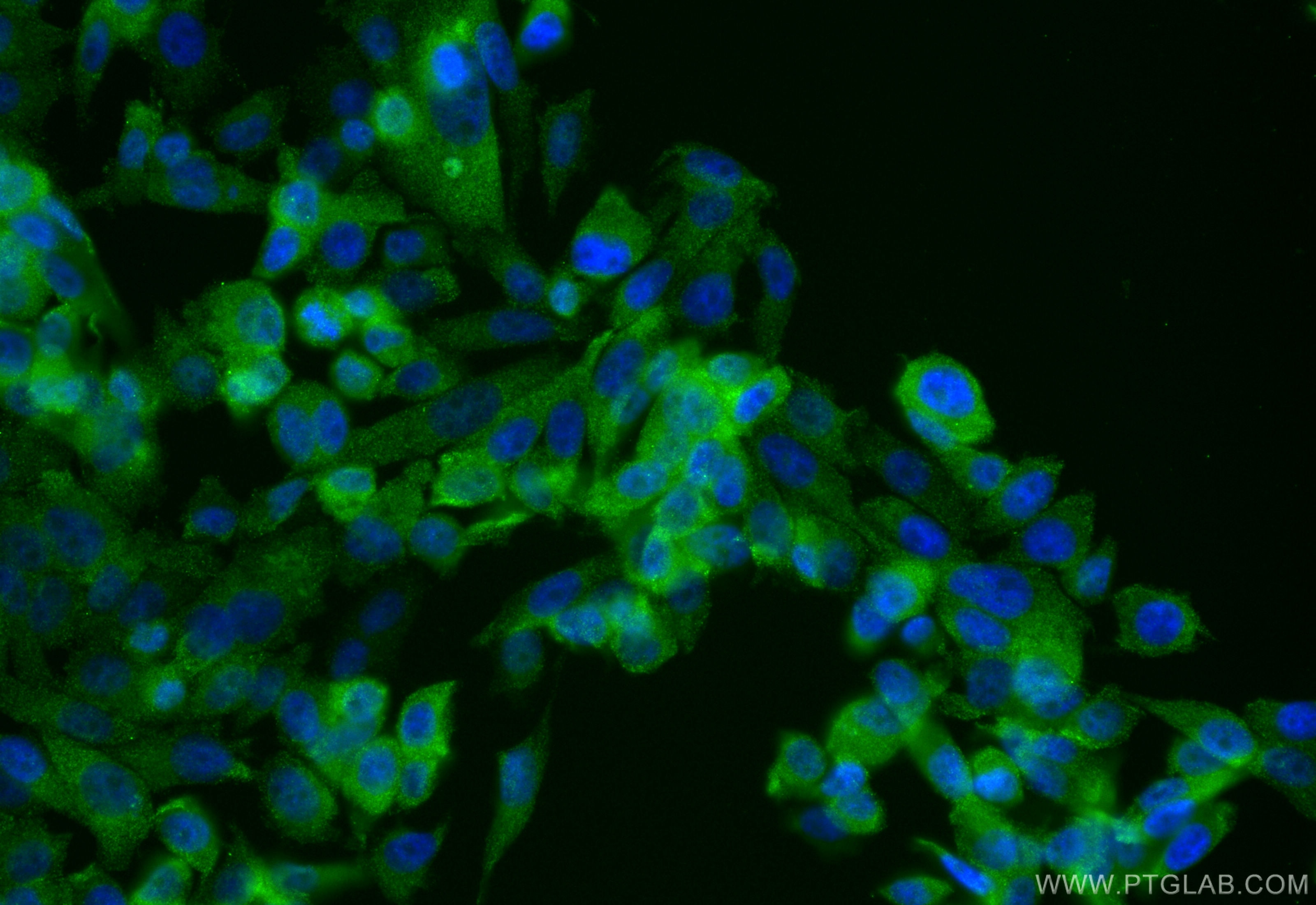 Immunofluorescence (IF) / fluorescent staining of PC-3 cells using PNMA1 Monoclonal antibody (68415-1-Ig)