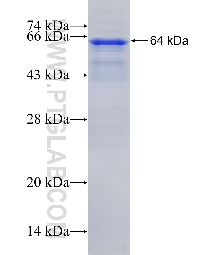 PNMA1 fusion protein Ag4549 SDS-PAGE