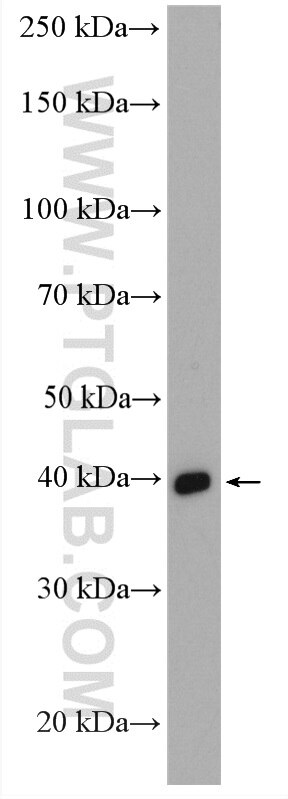 WB analysis of mouse brain using 16445-1-AP