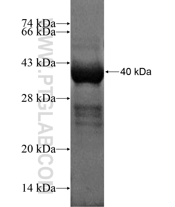 PNMA5 fusion protein Ag17222 SDS-PAGE