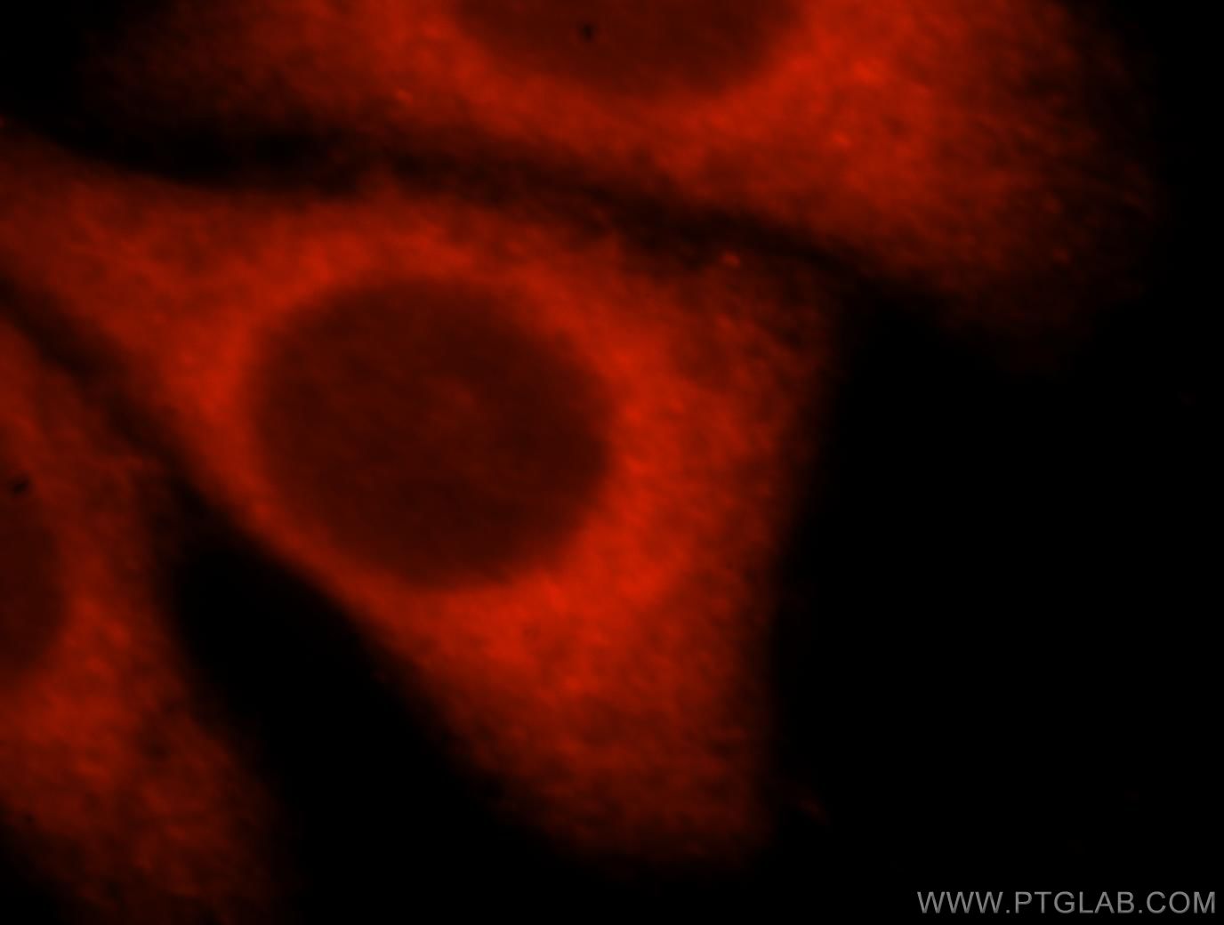Immunofluorescence (IF) / fluorescent staining of HepG2 cells using PNMAL1 Polyclonal antibody (16965-1-AP)