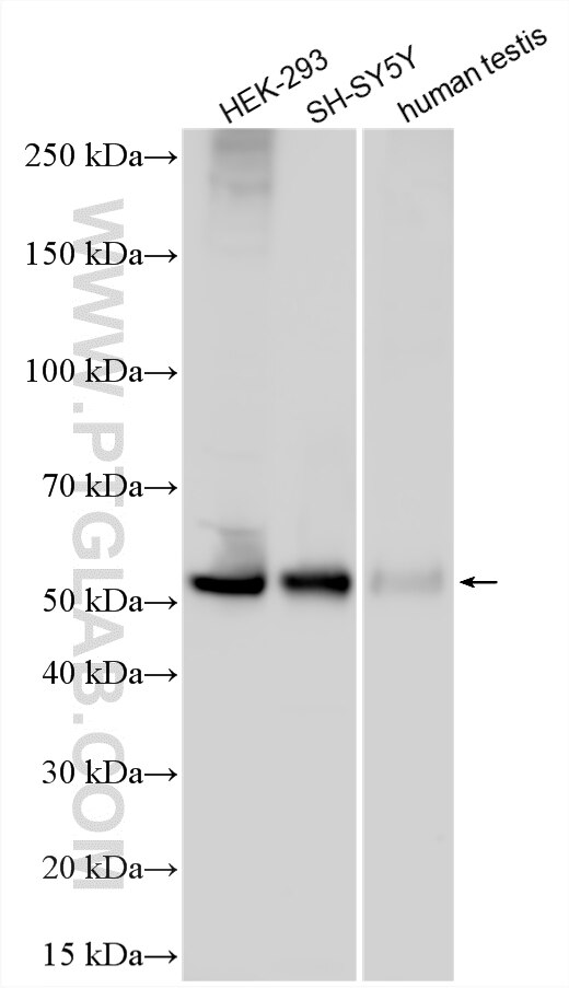 WB analysis using 16965-1-AP Western Blot (WB) analysis of various lysates using PNMAL1 Polyclonal antibody (16965-1-AP)