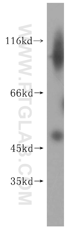 Western Blot (WB) analysis of HEK-293 cells using PNMAL1 Polyclonal antibody (16965-1-AP)