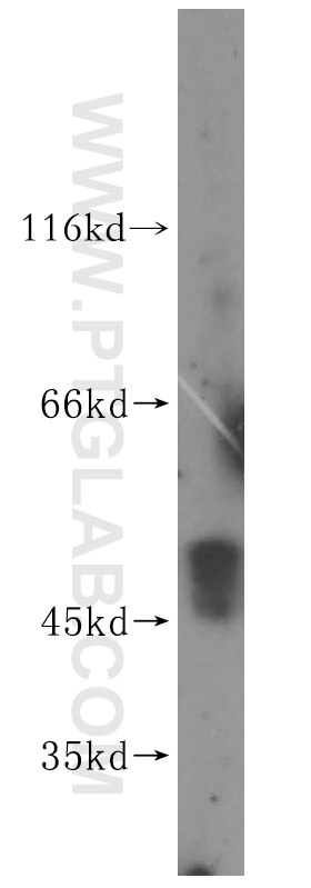 Western Blot (WB) analysis of A2780 cells using PNMAL1 Polyclonal antibody (16965-1-AP)