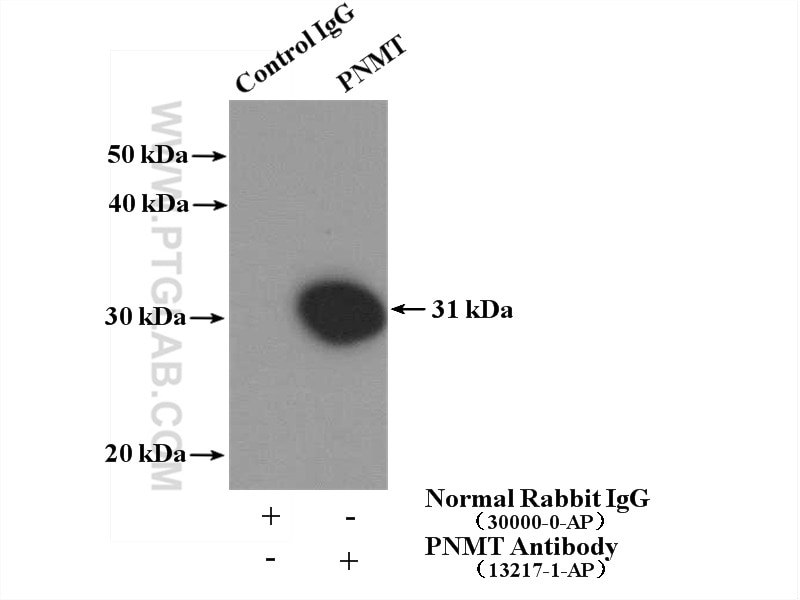 Immunoprecipitation (IP) experiment of PC-12 cells using PNMT Polyclonal antibody (13217-1-AP)