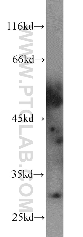 Western Blot (WB) analysis of human heart tissue using PNMT Polyclonal antibody (13217-1-AP)