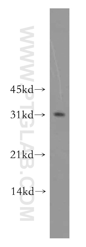 Western Blot (WB) analysis of K-562 cells using PNMT Polyclonal antibody (13217-1-AP)