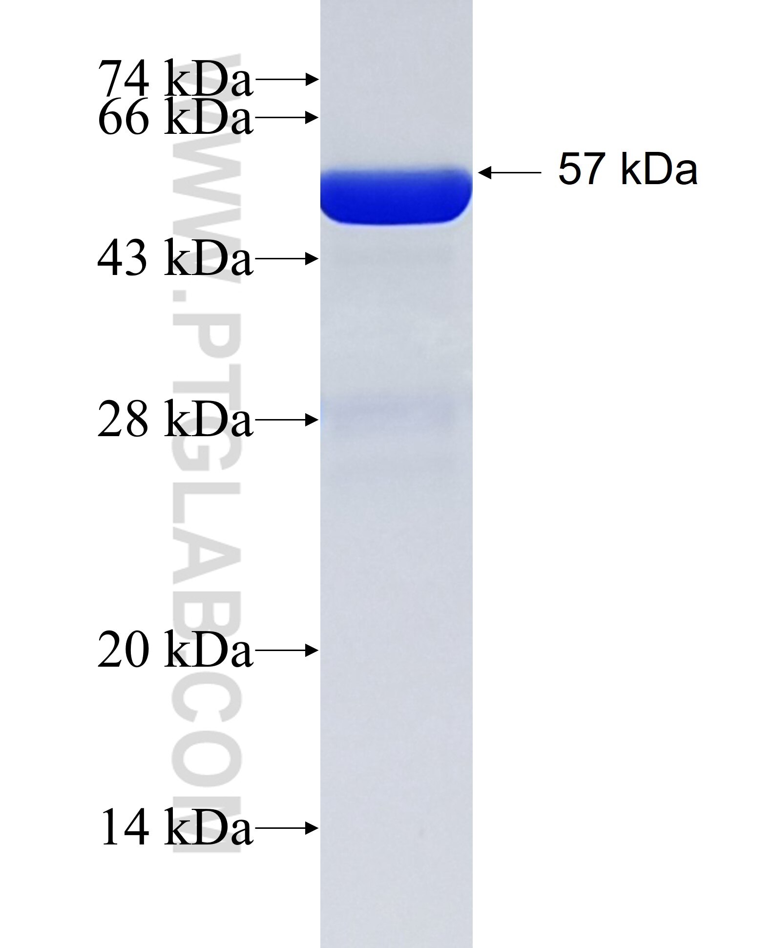 PNMT fusion protein Ag4098 SDS-PAGE