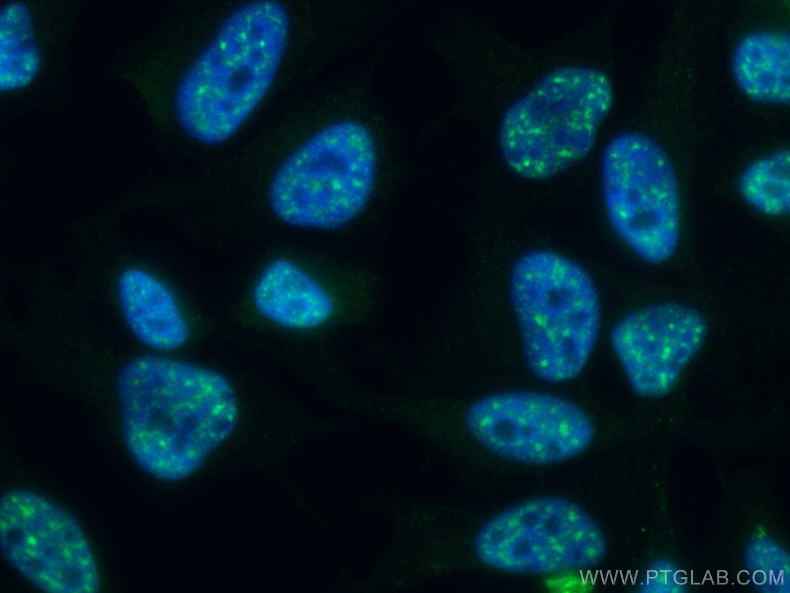 Immunofluorescence (IF) / fluorescent staining of HeLa cells using Pinin Polyclonal antibody (18266-1-AP)