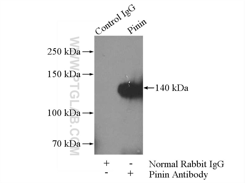 Immunoprecipitation (IP) experiment of HeLa cells using Pinin Polyclonal antibody (18266-1-AP)