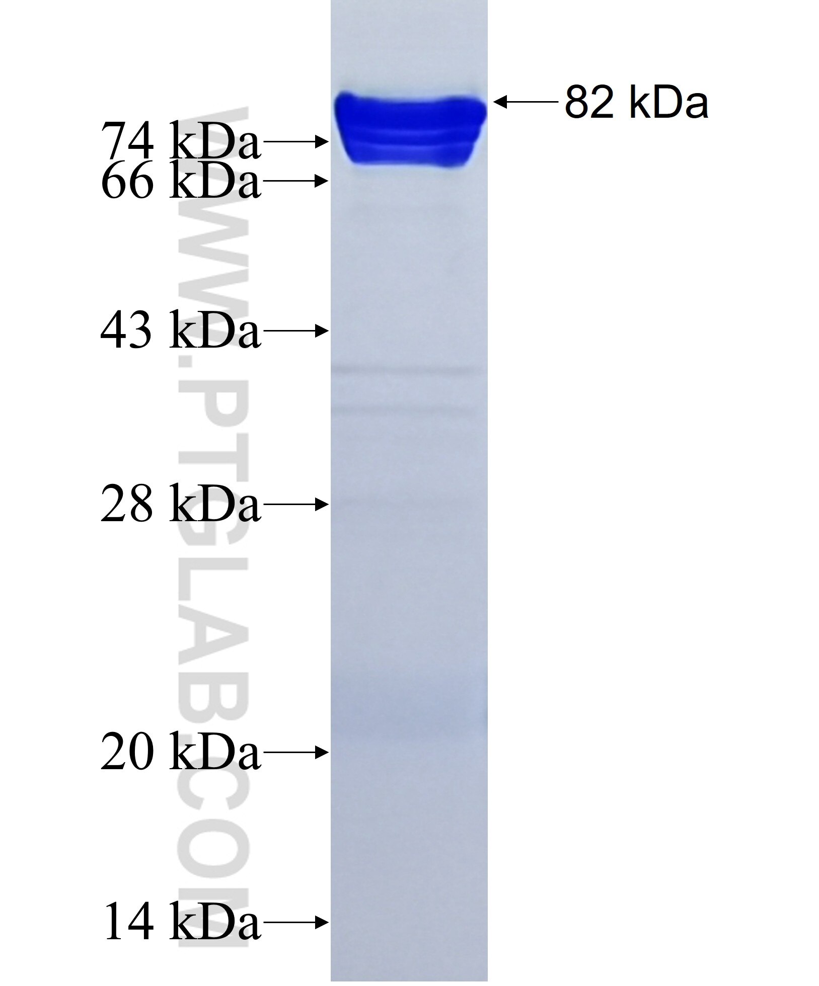 PNN fusion protein Ag38940 SDS-PAGE
