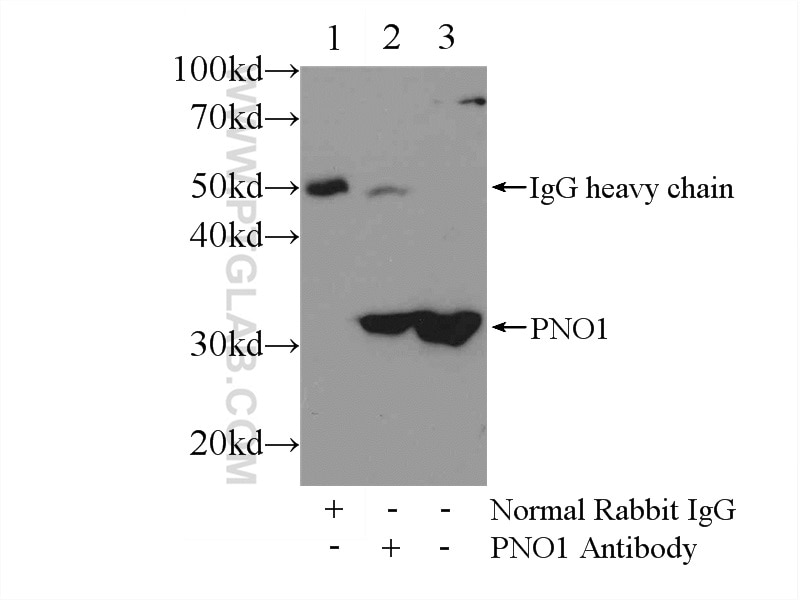 Immunoprecipitation (IP) experiment of L02 cells using PNO1 Polyclonal antibody (21059-1-AP)