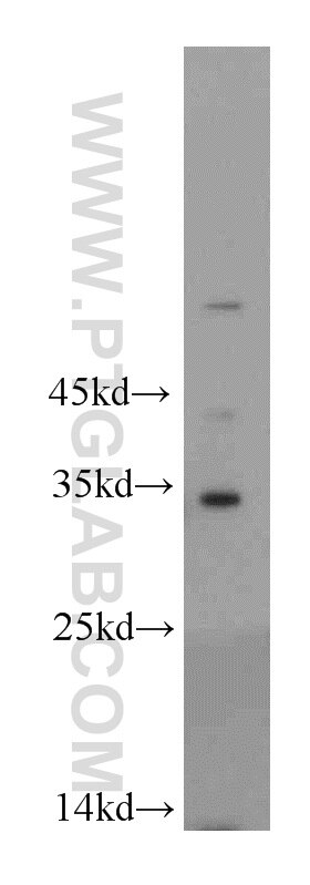 Western Blot (WB) analysis of mouse spleen tissue using PNO1 Polyclonal antibody (21059-1-AP)