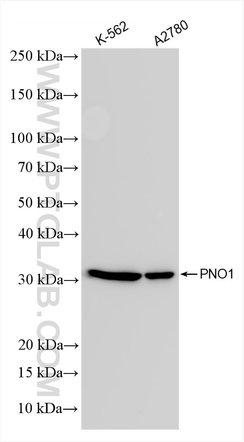 PNO1