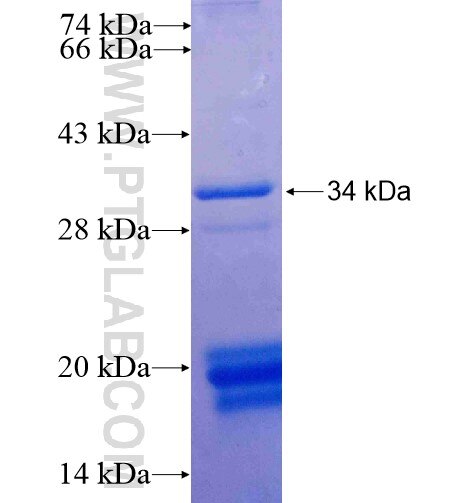 PNO1 fusion protein Ag14967 SDS-PAGE