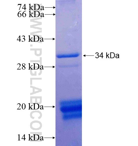 PNO1 fusion protein Ag14967 SDS-PAGE PNO1 fusion protein Ag14967 SDS-PAGE
