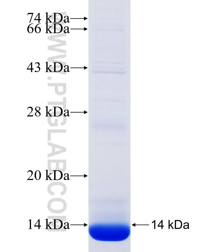 PNPLA1 fusion protein Ag35467 SDS-PAGE PNPLA1 fusion protein Ag35467 SDS-PAGE