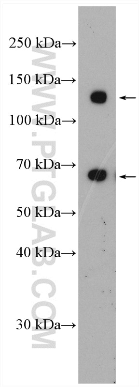 WB analysis of HepG2 using 11442-1-AP