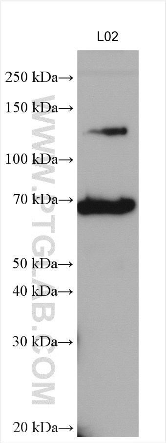 Western Blot (WB) analysis of various lysates using PNPLA3 Polyclonal antibody (11442-1-AP)