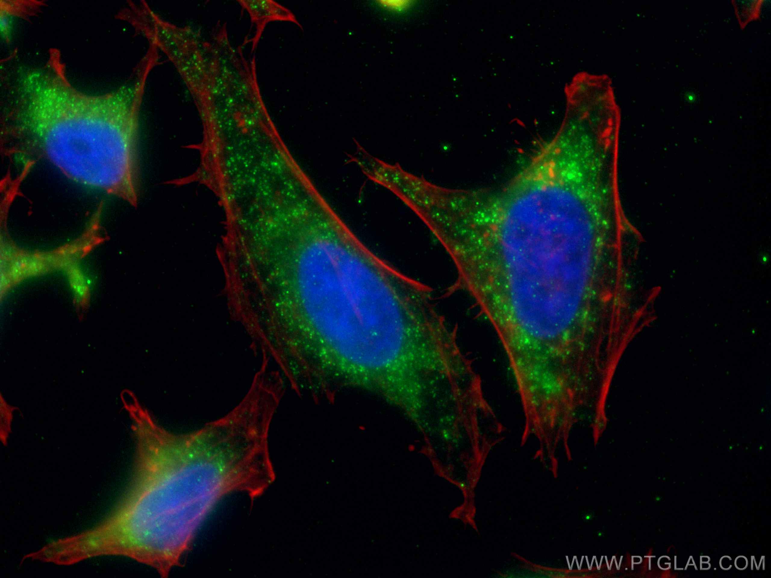Immunofluorescence (IF) / fluorescent staining of HeLa cells using PNPLA3 Monoclonal antibody (67369-1-Ig)