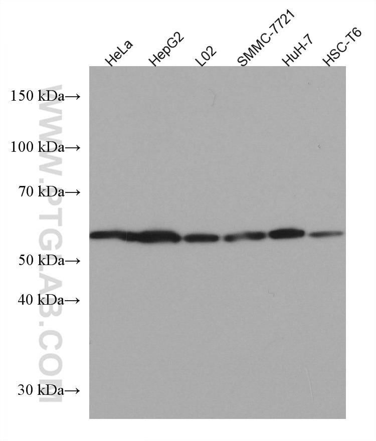 Western Blot (WB) analysis of various lysates using PNPLA3 Monoclonal antibody (67369-1-Ig)