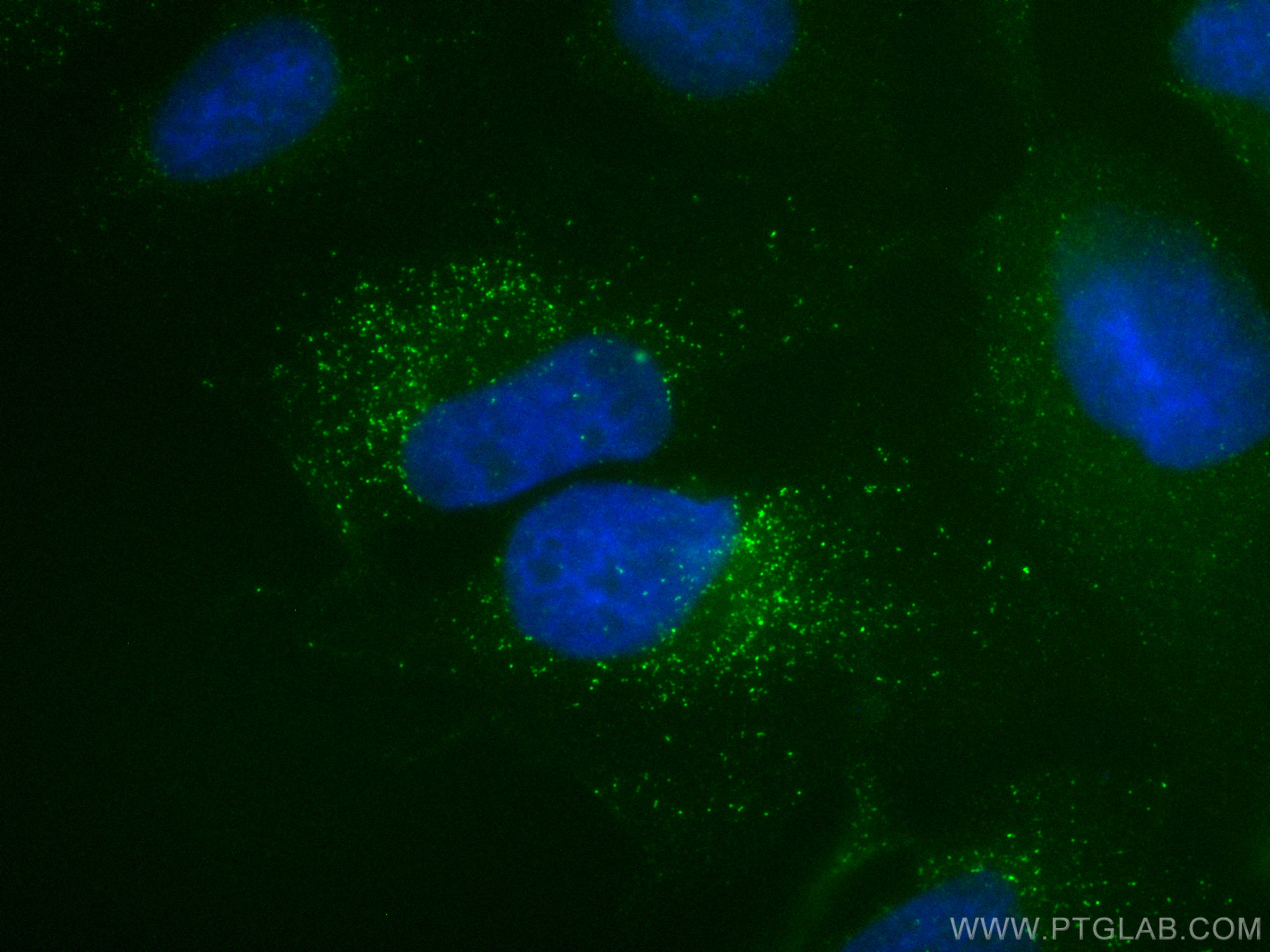 Immunofluorescence (IF) / fluorescent staining of HeLa cells using CoraLite® Plus 488-conjugated PNPLA3 Monoclonal an (CL488-67369)
