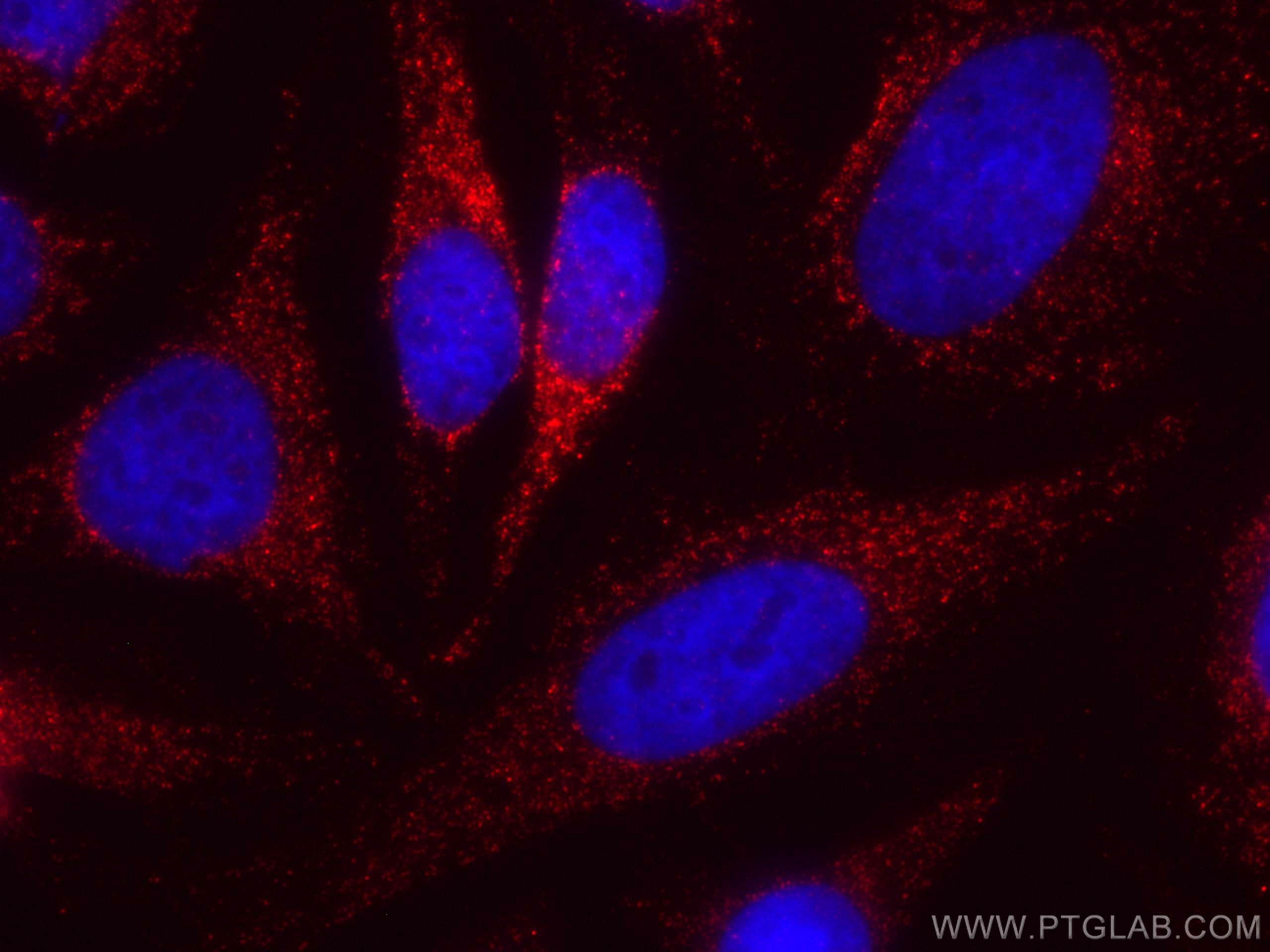 Immunofluorescence (IF) / fluorescent staining of HeLa cells using CoraLite®594-conjugated PNPLA3 Monoclonal antibody (CL594-67369)