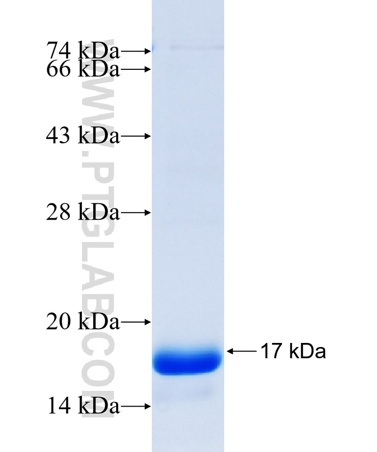PNPLA3 fusion protein Ag27407 SDS-PAGE