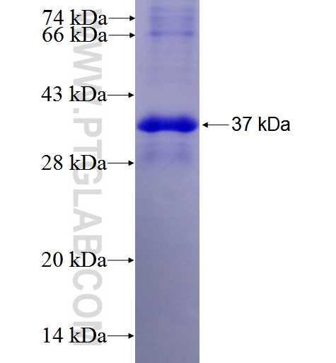 PNPLA3 fusion protein Ag1959 SDS-PAGE