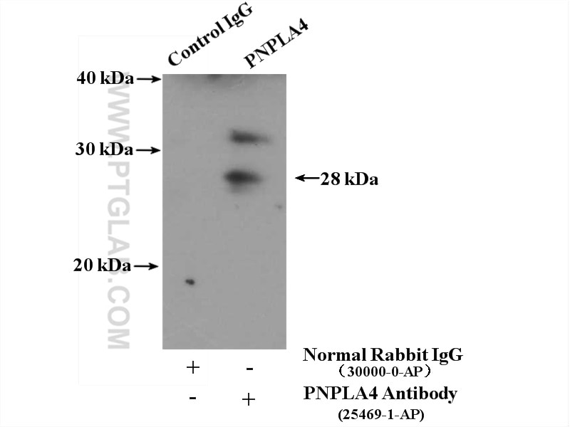 Immunoprecipitation (IP) experiment of HeLa cells using PNPLA4 Polyclonal antibody (25469-1-AP)