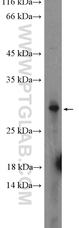 Western Blot (WB) analysis of HeLa cells using PNPLA4 Polyclonal antibody (25469-1-AP)