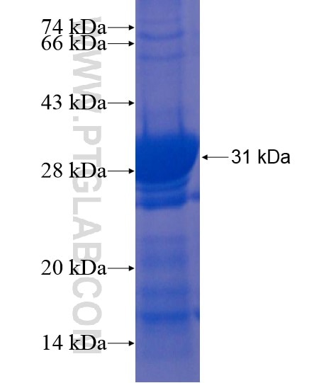 PNPLA4 fusion protein Ag22091 SDS-PAGE