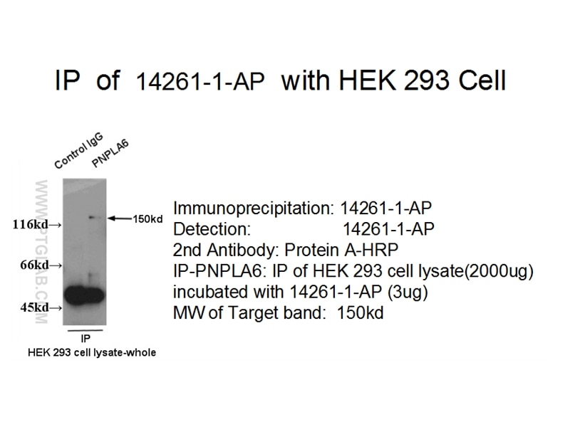 Immunoprecipitation (IP) experiment using PNPLA6 Polyclonal antibody (14261-1-AP)