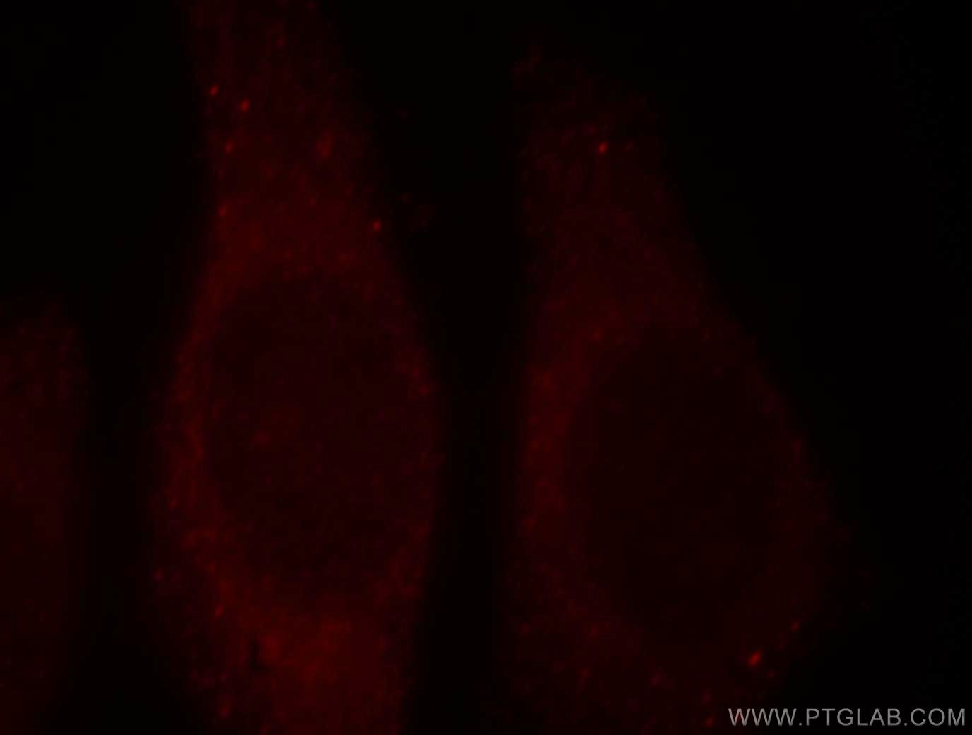 Immunofluorescence (IF) / fluorescent staining of HepG2 cells using PNPLA6 Polyclonal antibody (14261-1-AP)