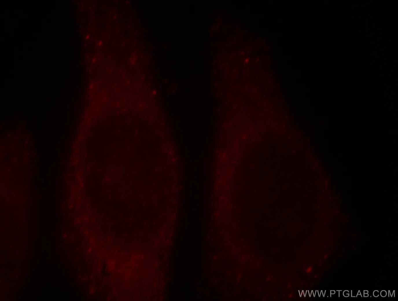 IF Staining of HepG2 using 14261-1-AP