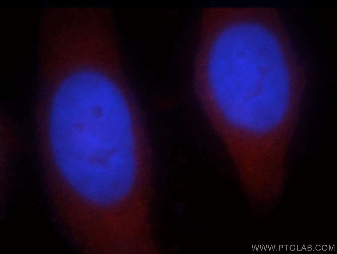 Immunofluorescence (IF) / fluorescent staining of MCF-7 cells using PNPLA6 Polyclonal antibody (14261-1-AP)