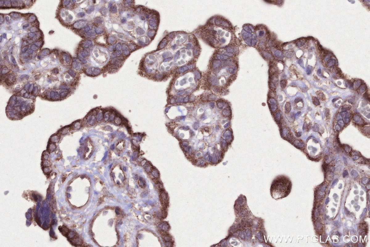 Immunohistochemistry (IHC) staining of human placenta tissue using PNPLA6 Polyclonal antibody (14261-1-AP)