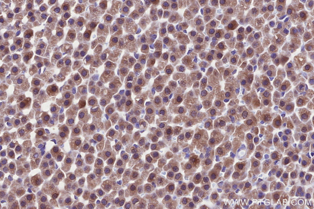 Immunohistochemistry (IHC) staining of rat adrenal gland tissue using PNPLA6 Polyclonal antibody (14261-1-AP)