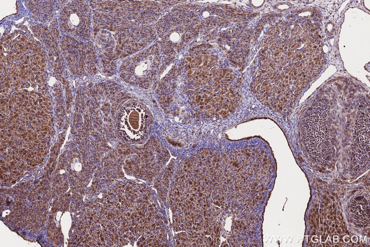 Immunohistochemistry (IHC) staining of rat ovary tissue using PNPLA6 Polyclonal antibody (14261-1-AP)