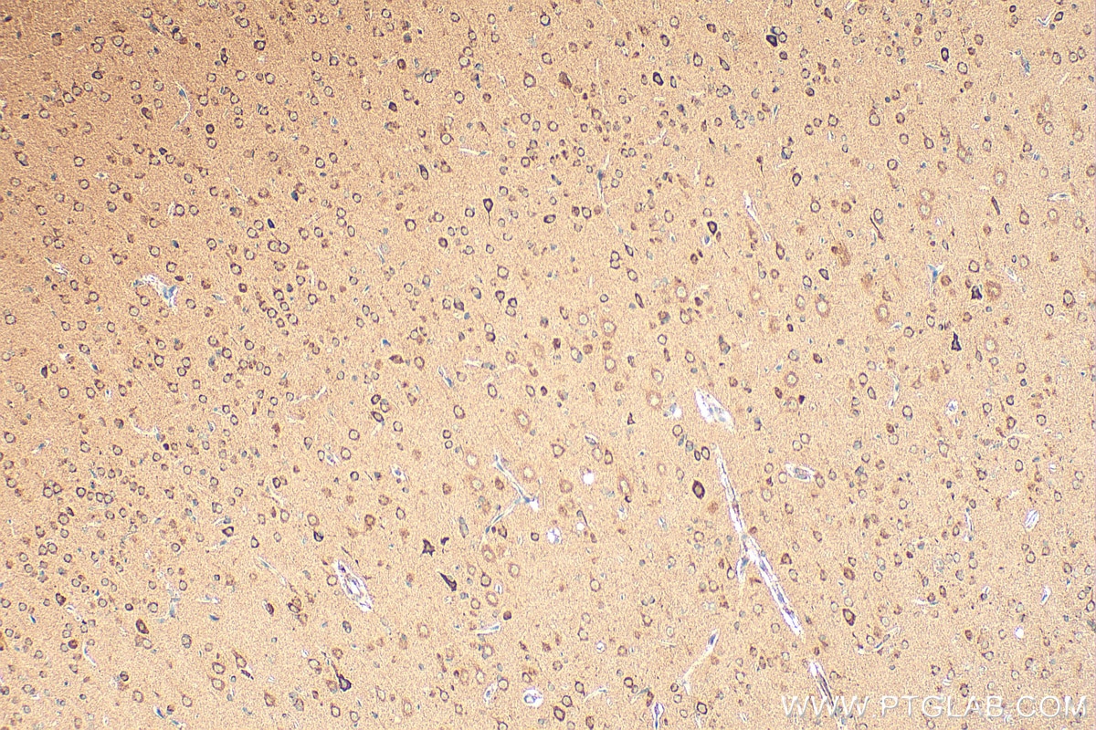 Immunohistochemistry (IHC) staining of rat brain tissue using PNPLA6 Polyclonal antibody (14261-1-AP)