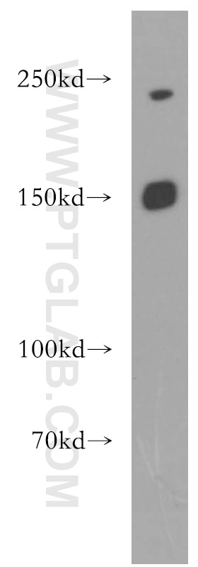 Western Blot (WB) analysis of SH-SY5Y cells using PNPLA6 Polyclonal antibody (14261-1-AP)