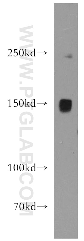 Western Blot (WB) analysis of HEK-293 cells using PNPLA6 Polyclonal antibody (14261-1-AP)