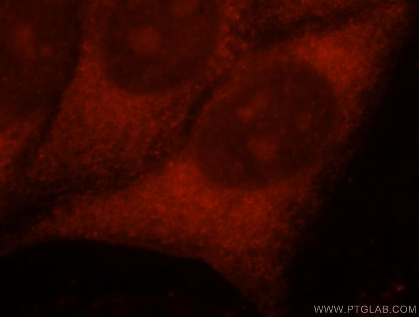Immunofluorescence (IF) / fluorescent staining of HeLa cells using PNPO Polyclonal antibody (15552-1-AP)