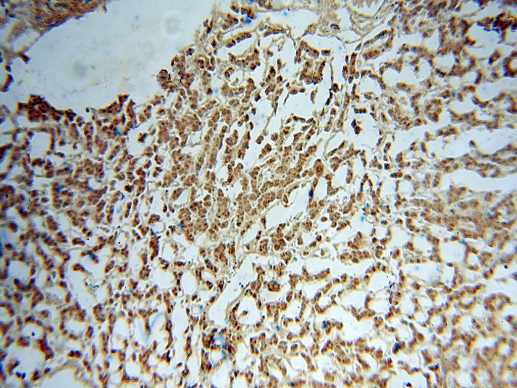 IHC staining of human liver using 15552-1-AP