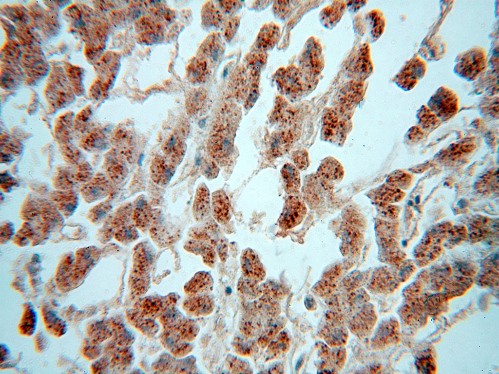 Immunohistochemistry (IHC) staining of human liver tissue using PNPO Polyclonal antibody (15552-1-AP)