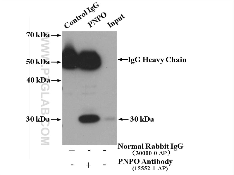 Immunoprecipitation (IP) experiment of MCF-7 cells using PNPO Polyclonal antibody (15552-1-AP)