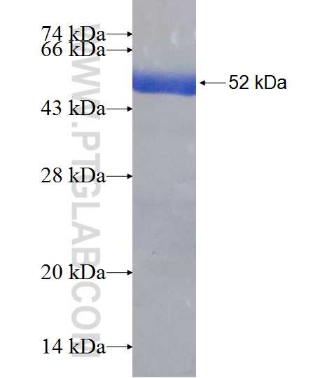 PNPO fusion protein Ag7914 SDS-PAGE