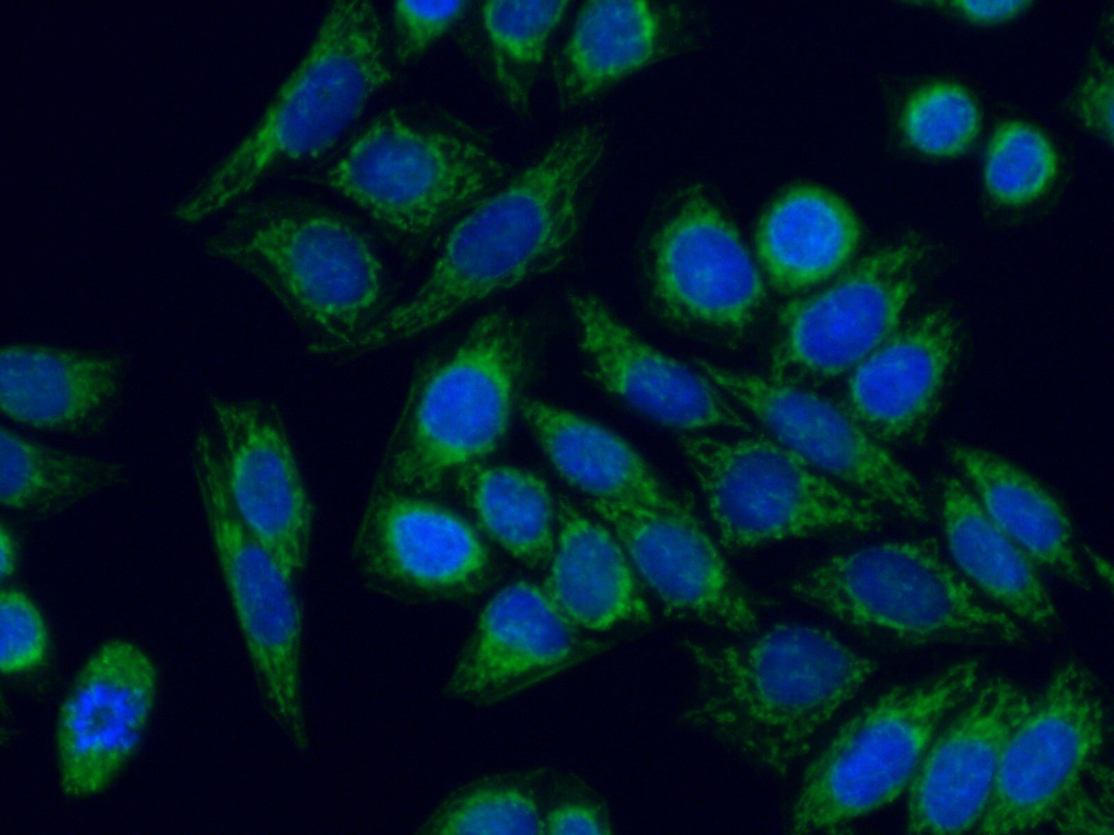 IF Staining of HeLa using 14487-1-AP