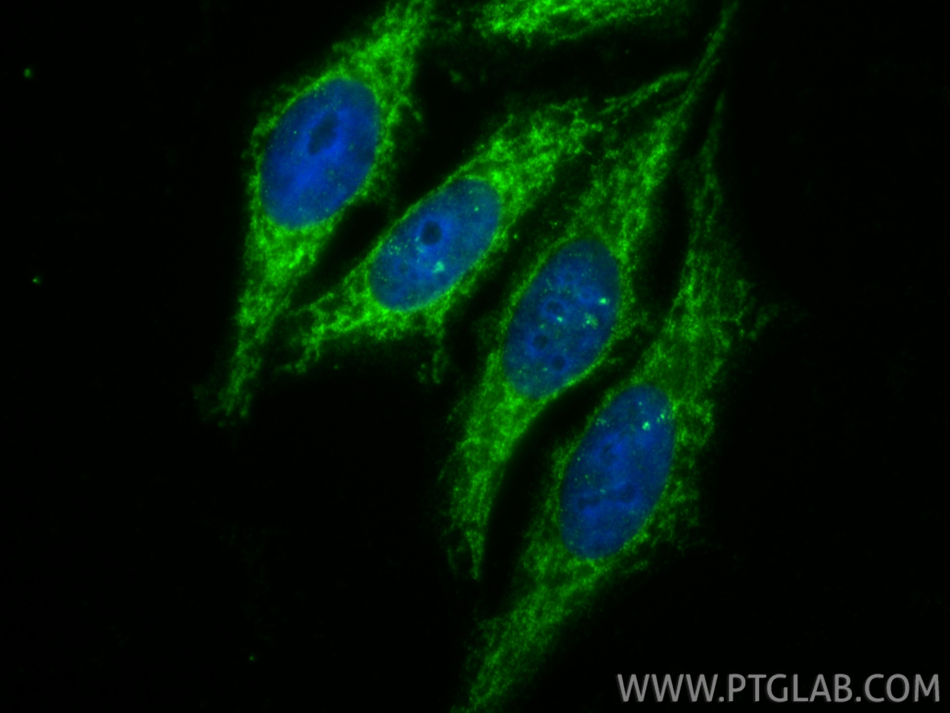 IF Staining of HepG2 using 14487-1-AP Immunofluorescence (IF) / fluorescent staining of HepG2 cells using PNPT1 Polyclonal antibody (14487-1-AP)