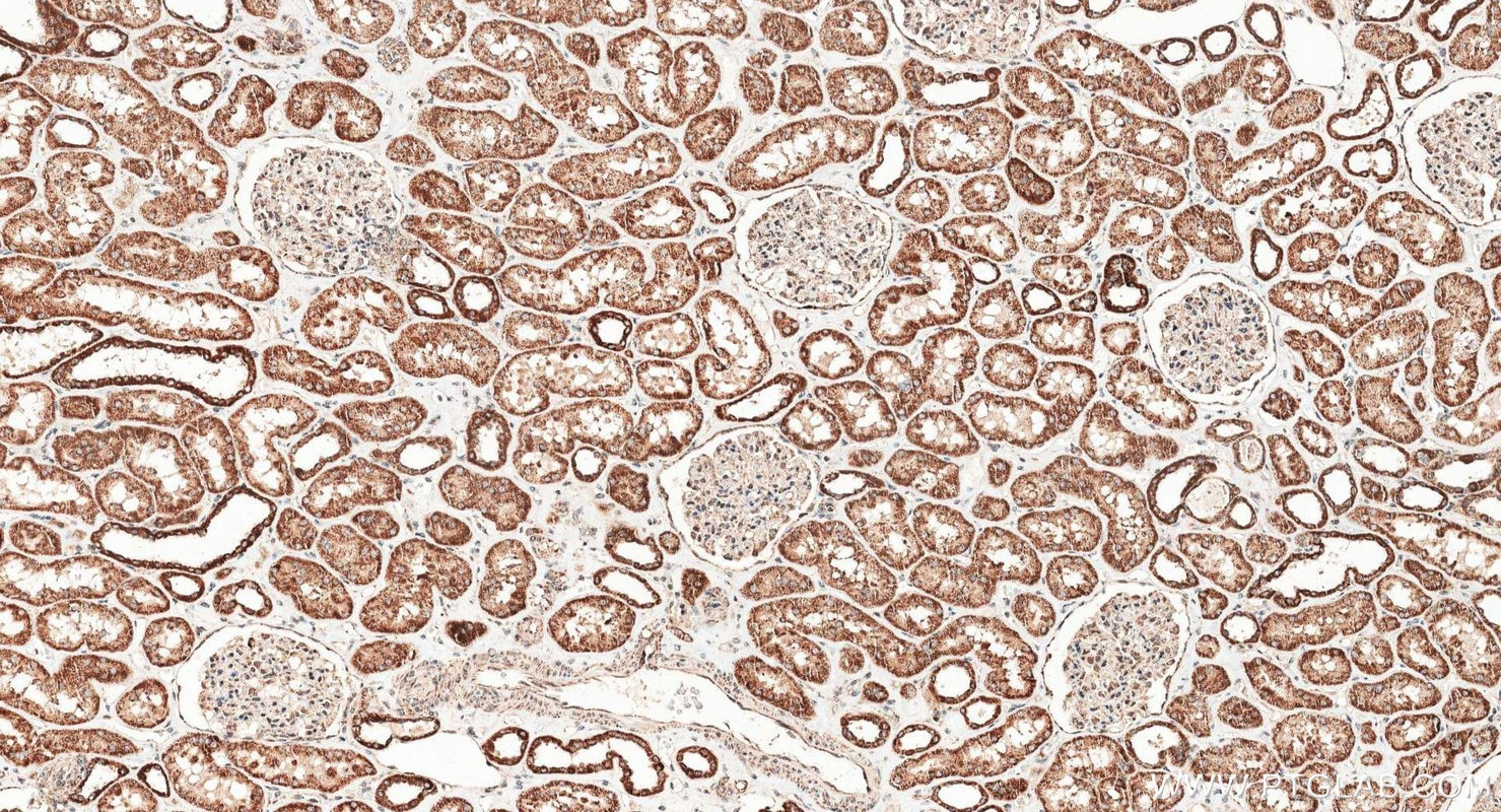 Immunohistochemistry (IHC) staining of human kidney tissue using PNPT1 Polyclonal antibody (14487-1-AP)